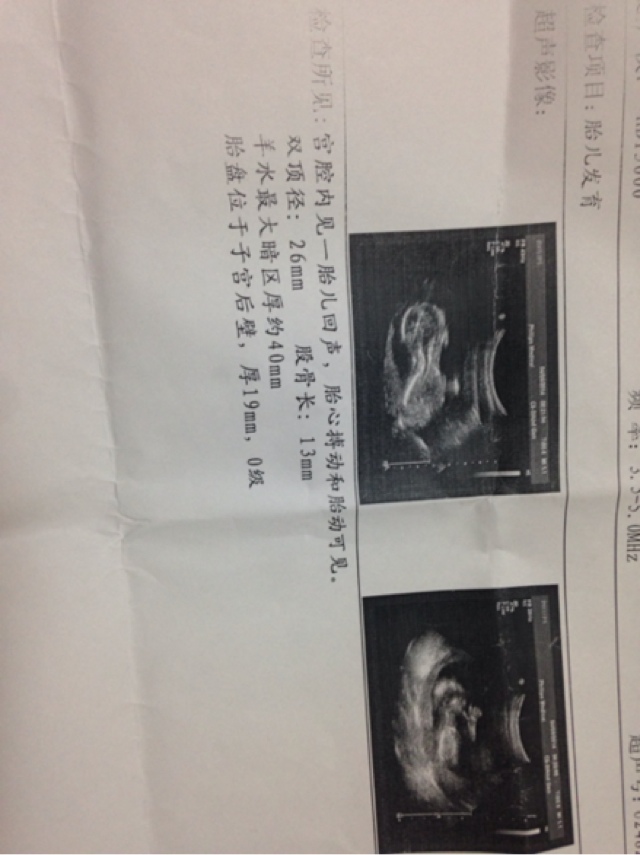 FPX重回冠军状态,Doinb刷“13虎”伤害,UZI:FPX还是猛的|星空体育APP网站(图2) 星空体育app下载